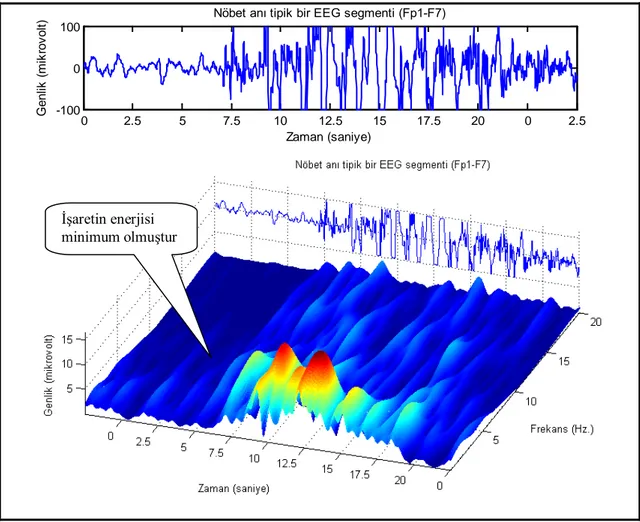Şekil 5. Epileptik bir EEG işaretinde tam nöbet anında zaman-frekans karakteristiğinde nasıl bir değişme  olduğu gösterilmiştir