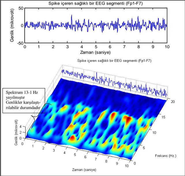 Şekil 7. Sağlıklı bir denekten alınan bir EEG örneğinin zaman-frekans karakteristiği. Sağlıklı bir EEG’de  spektrumun büyük oranda 0-13  Hz  aralığında  kaldığı  gözlenmektedir