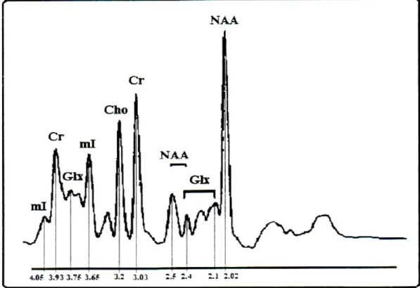 Şekil 1:  1 H MRS’de metabolitleri gösteren spektrum (12). 