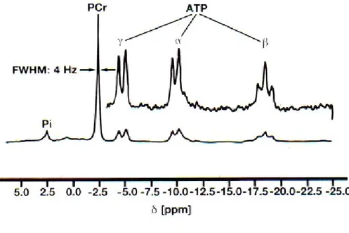 Şekil 2 :  31 P MRS’de metabolitleri gösteren spektrum (8).    Pİ: İnorganik fosfor , PCr: Fosfokreatin,  ATP: Adenozintrifosfat 