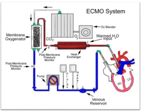 Şekil 1: ECMO sistemi. 