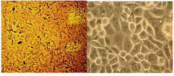 Şekil 3: MDAH-2774  (a)  ve OVCAR-3  (b)  hücre hatlarının inverted mikroskop 