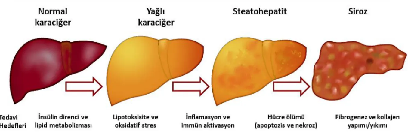 Şekil 6: NAYKH’ın klinik spektrumu 