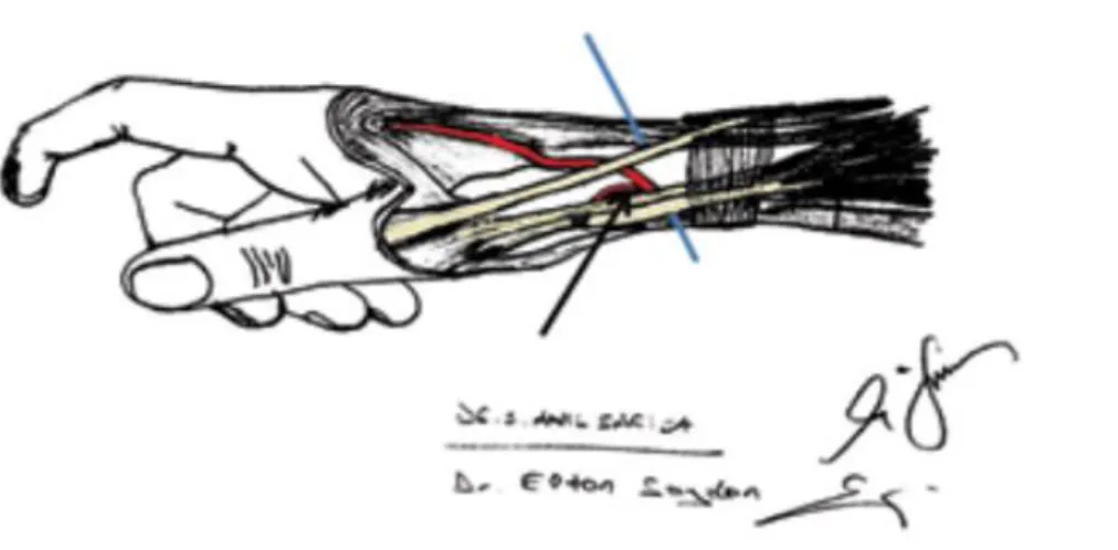 ġekil 2: Anatomik enfiye çukuru anatomisi ve distal radial arter 