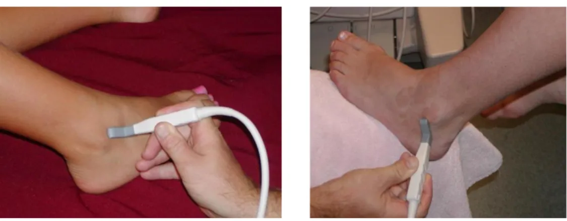 Şekil  2.16  Anterior  Talofibuler  Ligaman(ATFL)  ve  Kalkaneofibuler  Ligaman(CFL)  USG  ile  görüntüleme  pozisyonları  (ultrasoundpedia  ayak  bileği  bölümünden alıntıdır) 