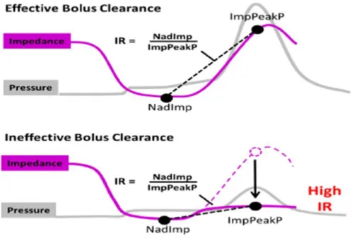 Şekil 8: Basınç-akım indeksinin formülü 