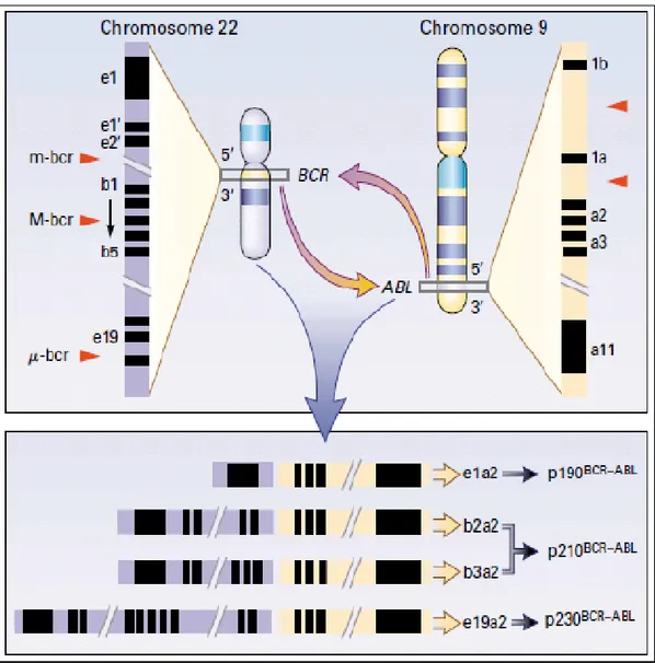 Şekil 1: KML’ de t(9;22) translokasyonu-Faderl ve ark. (10)’ dan alınmıştır. 