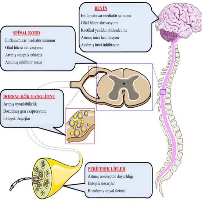 Şekil 1. Nöropatik ağrıya katkıda bulunan periferik ve merkezi mekanizmalar [15] 