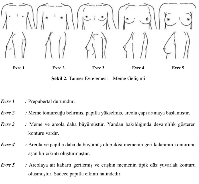 Şekil 2. Tanner Evrelemesi – Meme Gelişimi 