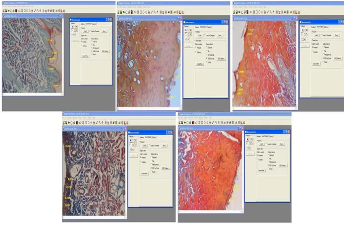 Şekil  13.  Bir Dijital Ölçüm Programı Olan  Image-Pro Express 4.5 (Media Cybernetics, 