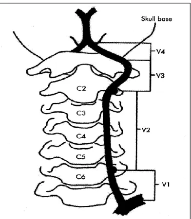 Şekil 1: Vertebral arter segmentlerinin şematizasyonu 