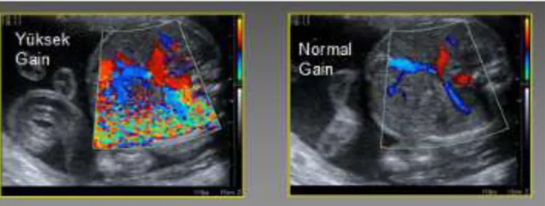 Şekil 4. Farklı değerlerdeki parametrelerin doppler görüntüsüne etkisi 