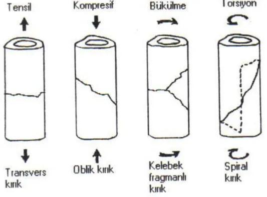 Şekil 6 : Kuvvetlere göre kırık çeşitleri  