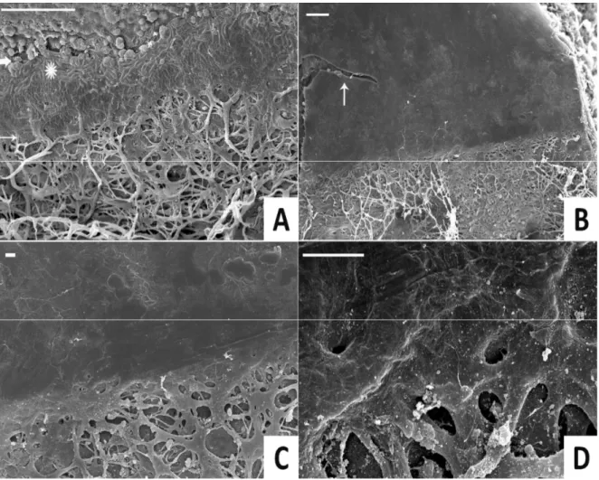 Şekil  9:  SEM  görüntüleri:  (A).  Periferik  kornea  ile  DM  in  situ.  Endotel  hücreleri  (kalın  ok)  kıvırcık  çizgili 