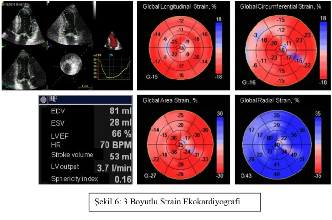 Şekil 6: 3 Boyutlu Strain Ekokardiyografi 