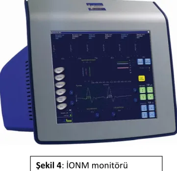 Şekil 4: İONM monitörü