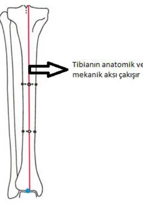 Şekil 11: Tibianın anatomik ve mekanik aksı 