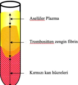 Şekil 2: Santrifüj sonrası oluşan 3 katmanlı tabaka ve trombositten zengin fibrin 