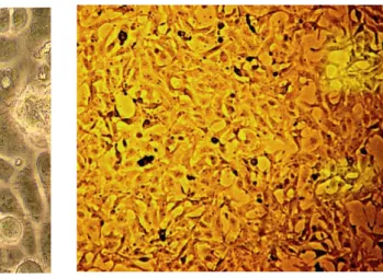 Şekil 3: OVCAR-3 (a) ve MDAH-2774 (b) hücre hatlarının inverted mikroskop  görüntüleri 