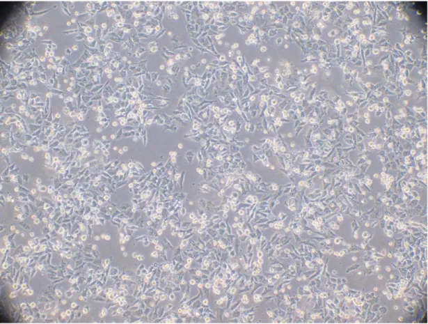 Şekil 3.  Du-145 Prostat Kanser Hücre Hattı hücrelerinin kontrast mikroskop altındaki  görüntüsü [6]