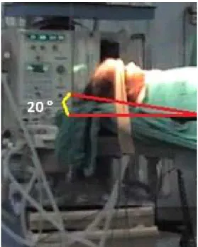 Şekil 4: E3Viçin başın pozisyonu  