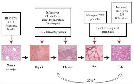 Şekil 1: Hepatokarsinogenez [20]. 