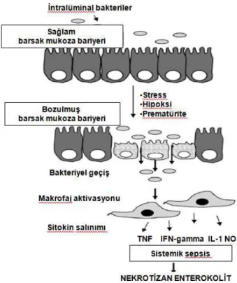 Şekil 5. NEK’in patogenezinde bozulmu ş  barsak mukoza bariyerinin rolü 