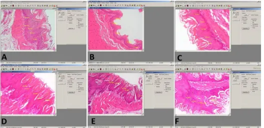 Şekil 29: Özofagus epitel kalınlığı ölçümünün Image-Pro Express 4.5 (Media                     Cybernetics, inc
