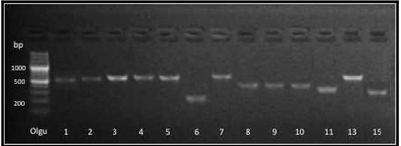 Şekil 2. BBS Genlerinin PCR Ürünleri Jel Görüntüsü 