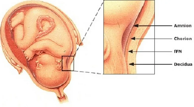 Şekil 1: Amnion ,koryon  ve desidua ( 151) 