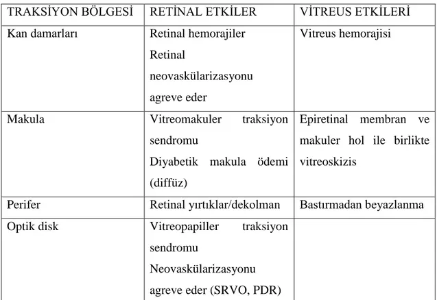 Tablo 1 Anormal PVD' nin vitreus ve retina üzerine etkileri 