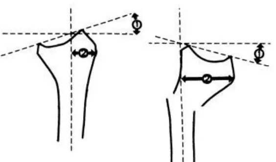 şekil      Şekil 19,20:Dorsal Açılanma 