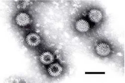 Şekil 1. Rotavirus elektron mikroskopik görünüm 