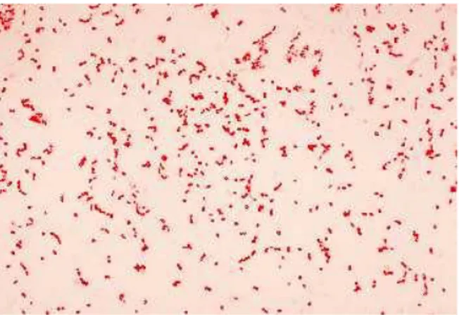 Şekil 1.8. Acinetobacter baumannii mikroskop görüntüsü  