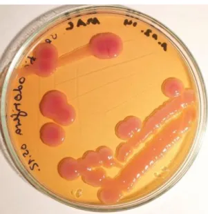 Şekil 1.12. Serratia odorifera petri kabındaki görüntüsü  