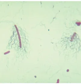 Şekil 1.14. Proteus vulgaris mikroskop görünütüsü  