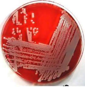 Şekil 1.17. Staphylococcus aureus petri kabı görüntüsü  