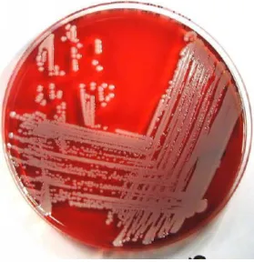 Şekil 1.17. Staphylococcus aureus petri kabı görüntüsü  