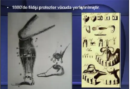 Şekil 2.2 İlk implantlar 