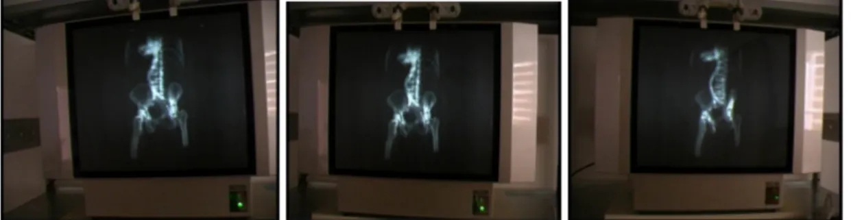 Şekil 35:X-ray CT sunumu