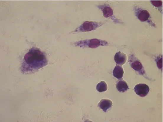 Şekil 4.16 250 μg/ml POX’a bir saat maruz kalmış L.infantum promastigotları ile enfekte  olmuş J774 makrofaj hücreleri (Giemsa boyama, 24 saat sonra, 100x) 