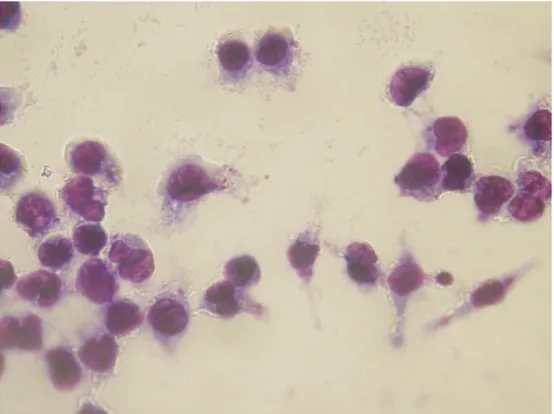 Şekil 4.18 2000 μg/ml POX’a bir saat maruz kalmış L.infantum promastigotları ile  enfekte olmuş J774 makrofaj hücreleri (Giemsa boyama, 24 saat sonra, 100x) 