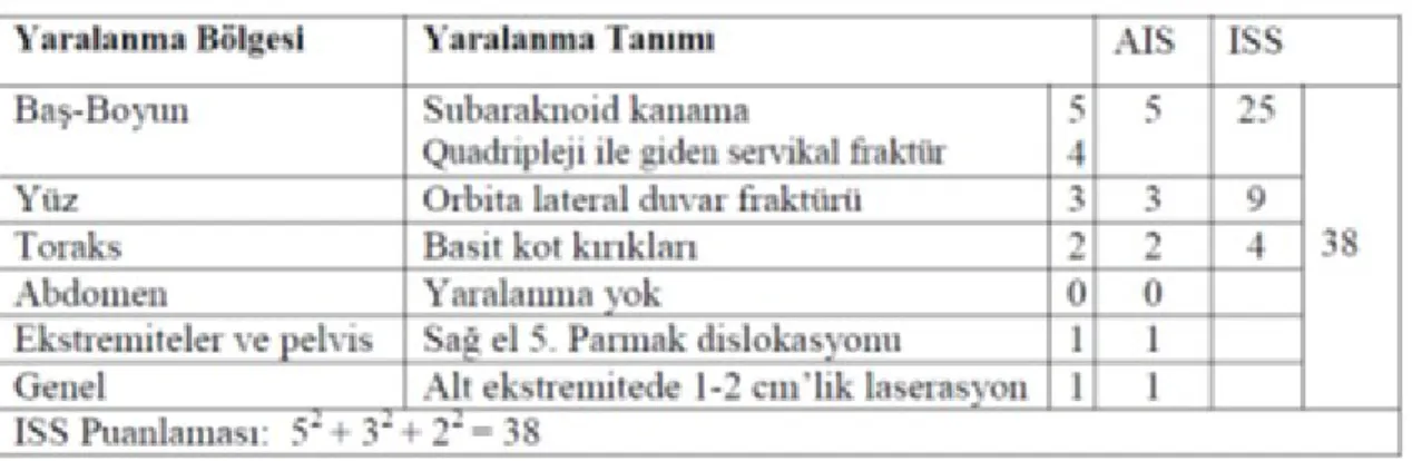 Tablo 3: AIS ve ISS  hesaplamasına örnek