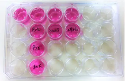 Şekil 3.2: PBMC hücrelerine Erk1/2 ,P38, JNK, STAT3 ve NFkB inhibitörlerinin uygulaması .