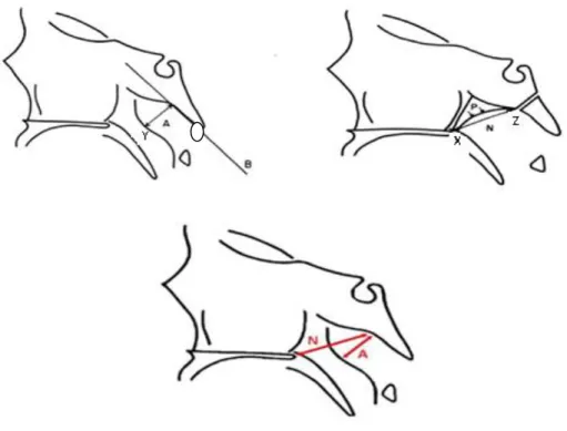 Şekil 5: Adenoid / Nazofarengeal Oran Ölçümü (A/ N)