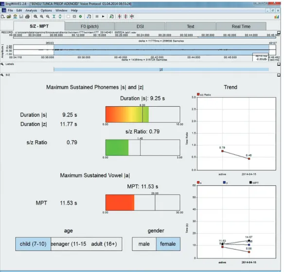 Şekil 2. Lingwaves Voice Protocol Modülü ile sesin aerodinamik değerlendirilmesi