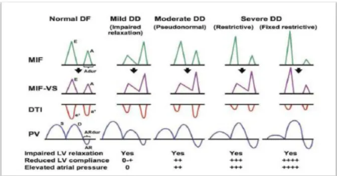 Şekil   7-Mitral   inflow   (üst-sol),   renkli   M-mod   (üst-sağ)   ve   mitral   anulüs   TDI   (alt-sol; lateral anulüs, alt-sağ;mediyal annulüs) ) normal ekokardiyografik patternleri