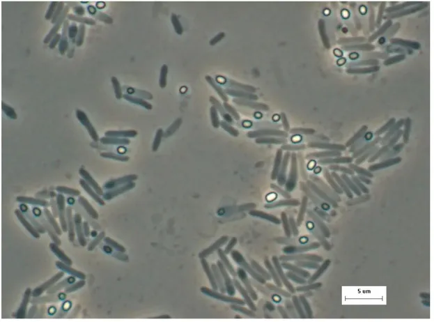 Şekil 3.1. KG8'in Mikroskopik Görüntüsü  (Gül-Güven, 2007 ) 