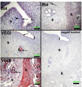 Şekil 2. Anöstrus süresince sıçan uterusunda flt4 ve VEGI’nın lokalizasyonu, AEC kromojen
