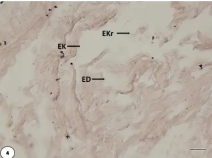 Şekil 4. %1’lik PCB’e maruz kalan elastin dokusu: Elastin deformasyonu (ED), Elastin kaybı (EK), Elastin 